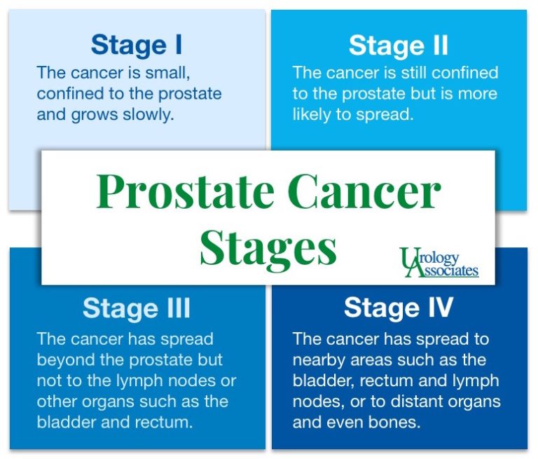 Prostate Cancer Stages & Options | Urology Associates | CO