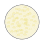 Cloudy or foamy urine | Urology Associates | Denver, CO