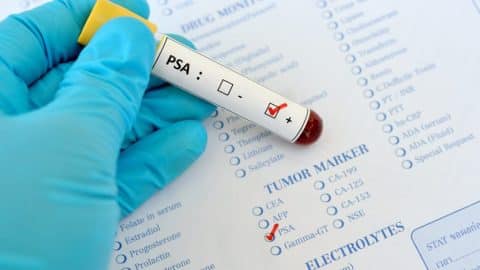 PSA imgae 1 1 1024x682 3